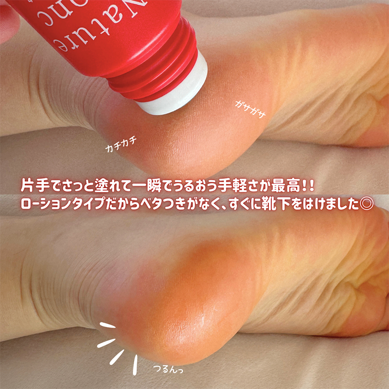 【11月優惠】秋冬必備 Nature Conc 瞬效修護足部護理液