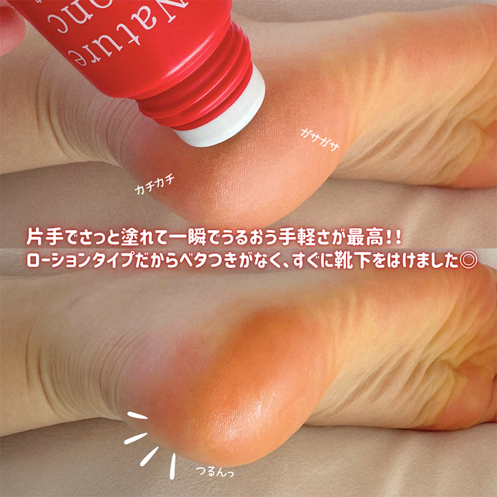 【11月優惠】秋冬必備 Nature Conc 瞬效修護足部護理液